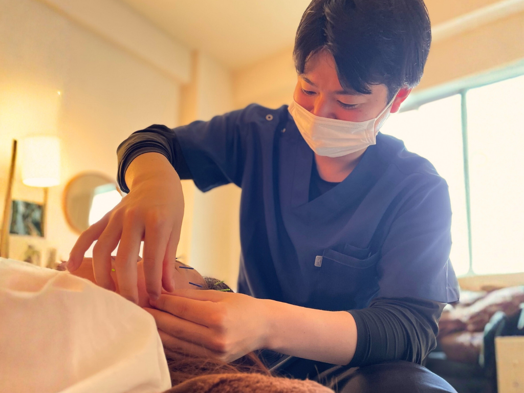 男性鍼灸師が女性の顔に美容鍼を施術している様子